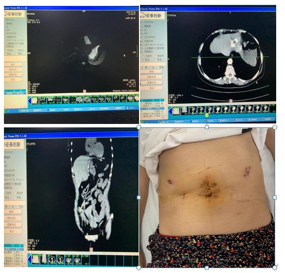 Snipaste_2023-07-26_08-32-32.jpg Snipaste_2023-07-26_08-32-32.jpg