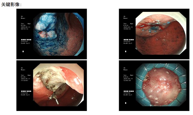 Snipaste_2025-01-20_14-48-54.jpg Snipaste_2025-01-20_14-48-54.jpg