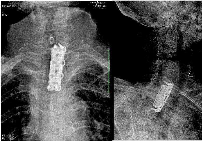 Snipaste_2025-09-09_10-53-46.jpg Snipaste_2025-09-09_10-53-46.jpg